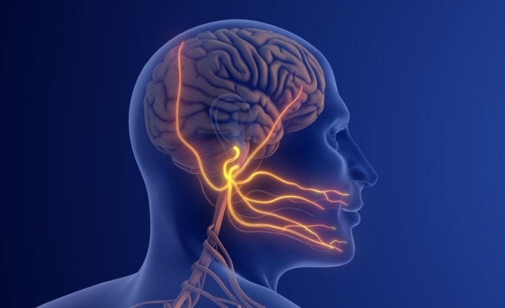 Νευραλγία τριδύμου